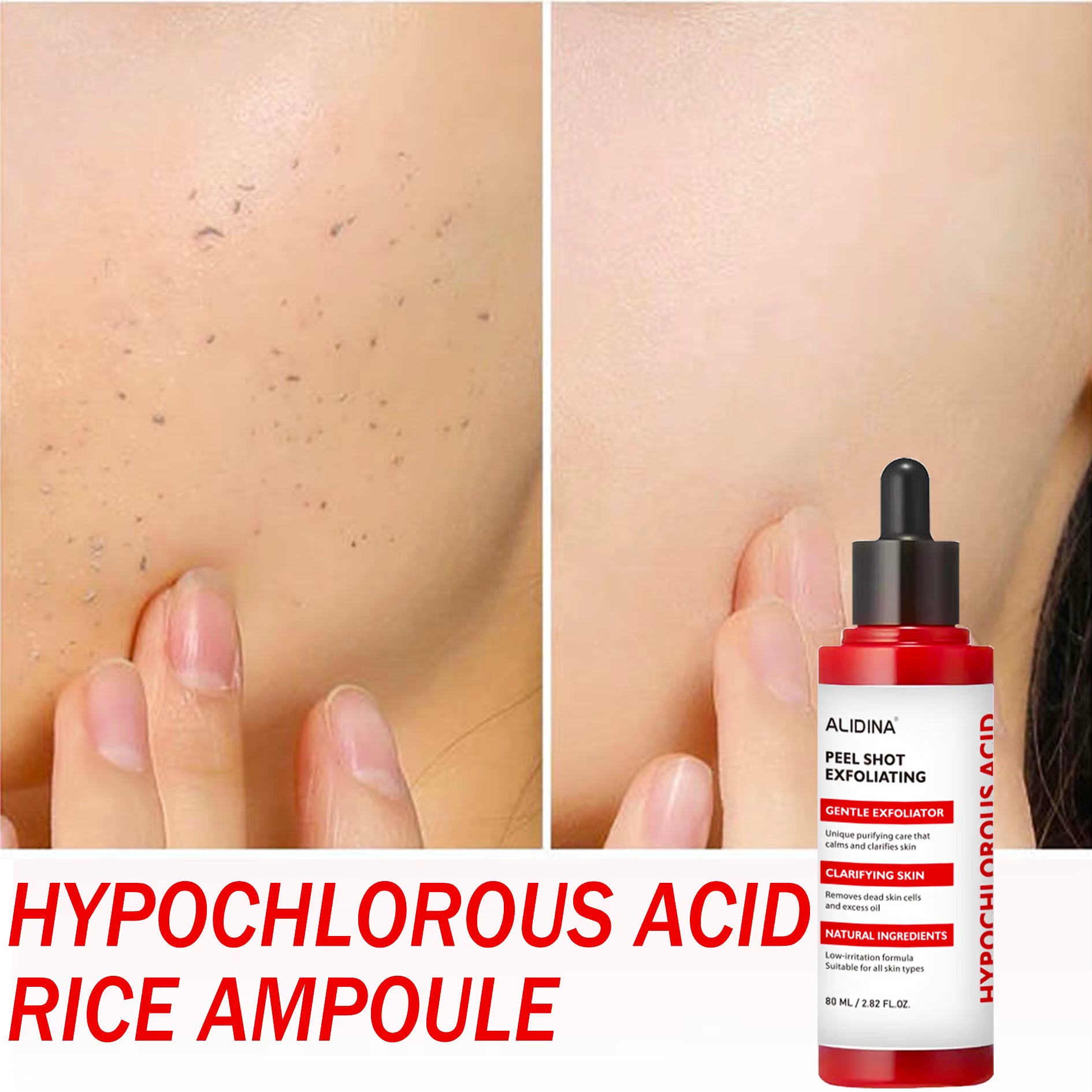 Face Peel Exfoliating Serum