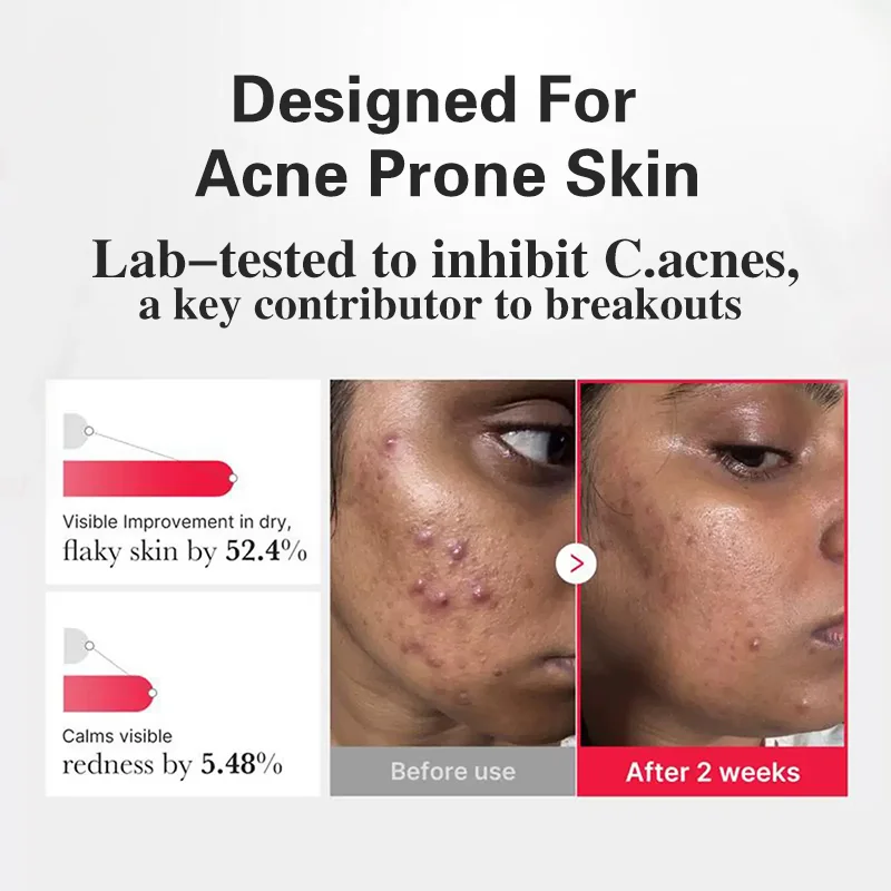 Face Peel Exfoliating Serum